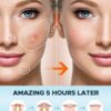 36 pcs Acne Patch Pimple Patch