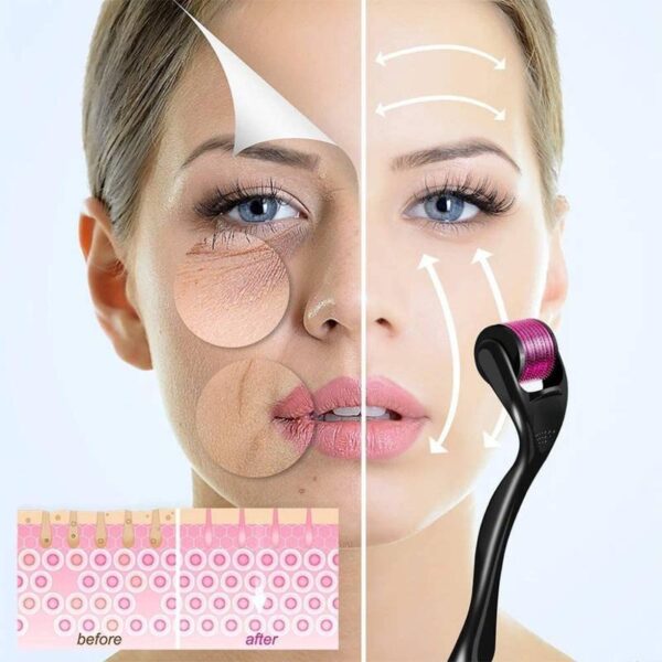 Derma-Roller-Face-Acne-Scars-R7-1678795560 Derma Roller Face Acne Scars Remover
