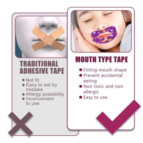 Anti Snoring Lips Strips 30 pcs