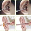 6-in-1-Ear-Wax-Cleaner-set1-1762928150 6 in 1 Ear Wax Cleaner set