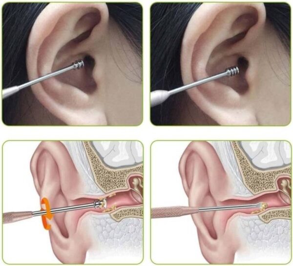 6-in-1-Ear-Wax-Cleaner-set1-1762928150 6 in 1 Ear Wax Cleaner set