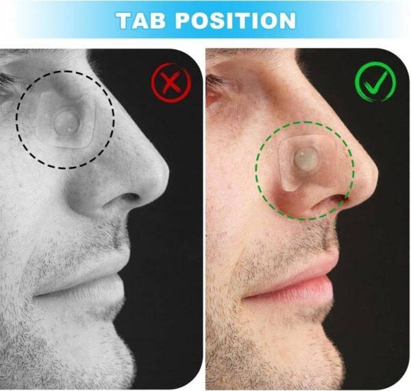 Breathing Nasal Strip