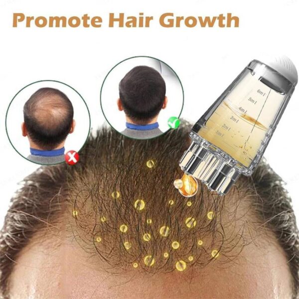 Hair-Oil-applicator-10ml2-1758890327 Hair Oil applicator 10ml
