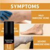 Varicose-Veins-Spray-30-Ml3-1773307663 Varicose Veins Spray 30 ML