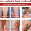 Varicose Veins Patches 12 pcs