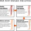 Varicose Veins Patches 12 pcs